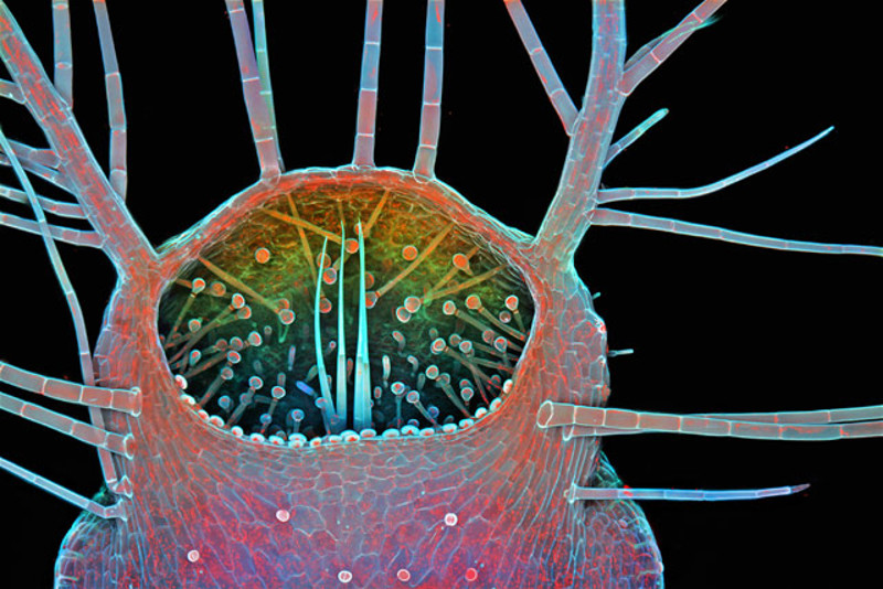 Illustration for article titled These Are the Best Microscopic Images of 2015